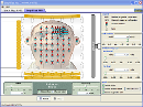 Screenshot of the simulation IRM Simplificada